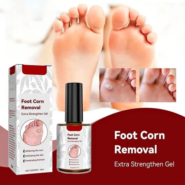 Food Corn Removal Gel - Image 2